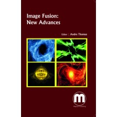 IMAGE FUSION: NEW ADVANCES